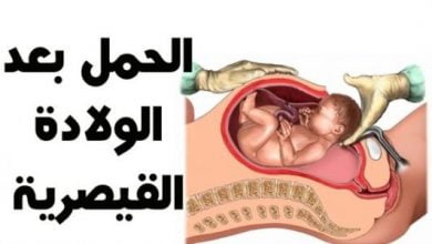 الحمل بعد الولادة القيصرية
