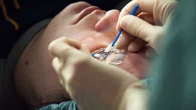 عمليات الليزك - علاج ضعف البصر
